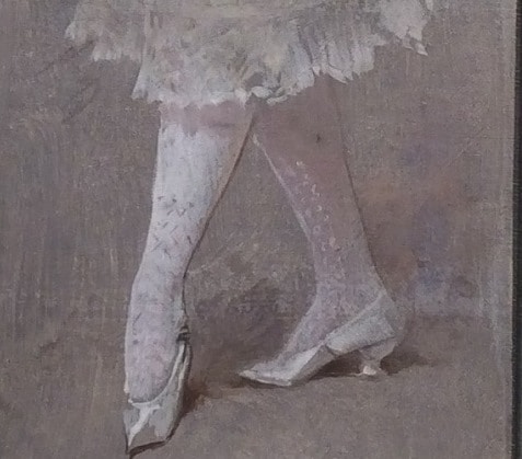 Kammerer's White Stockings. A depiction of a ballet dancer's turning foot.